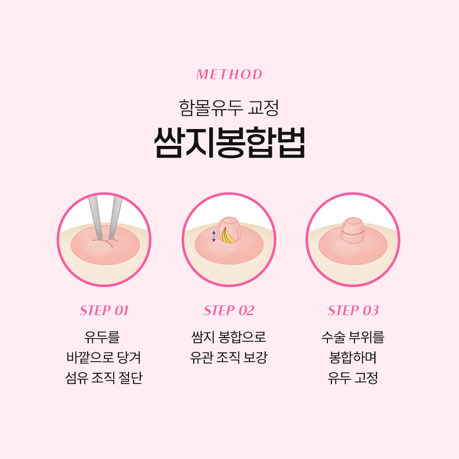How Female Inverted Nipple Correction Surgery Is Performed image 6