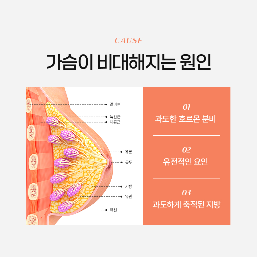 가슴축소성형, 단순한 미용이 아닌 삶의 질 회복 관련 이미지 3