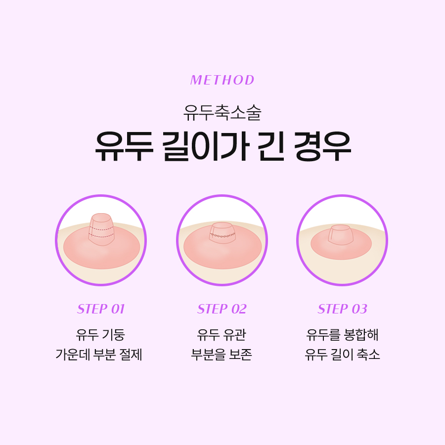 유두교정수술병원 티 나지 않는 자연스러운 유두축소술 관련 이미지 5
