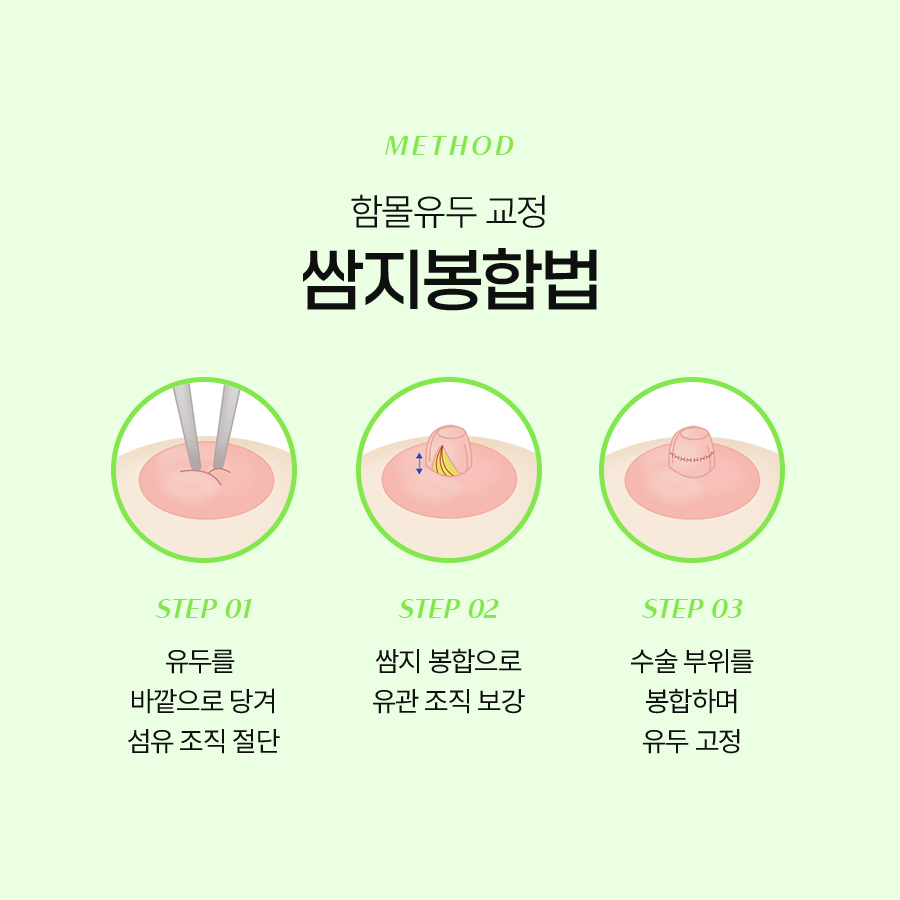 여성함몰유두교정, 다시 함몰되지 않으려면 확인해야 할 부분 관련 이미지 5