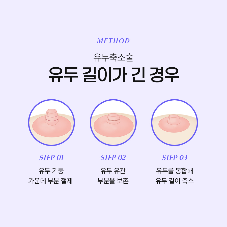 가슴유두축소술 매력적인 변화로 자신감을 높이는 선택 관련 이미지 5