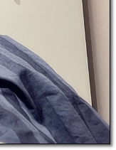 Recommended Breast Revision Surgery Clinics: Why the Triple-Plane Technique Is Drawing Attention image 18