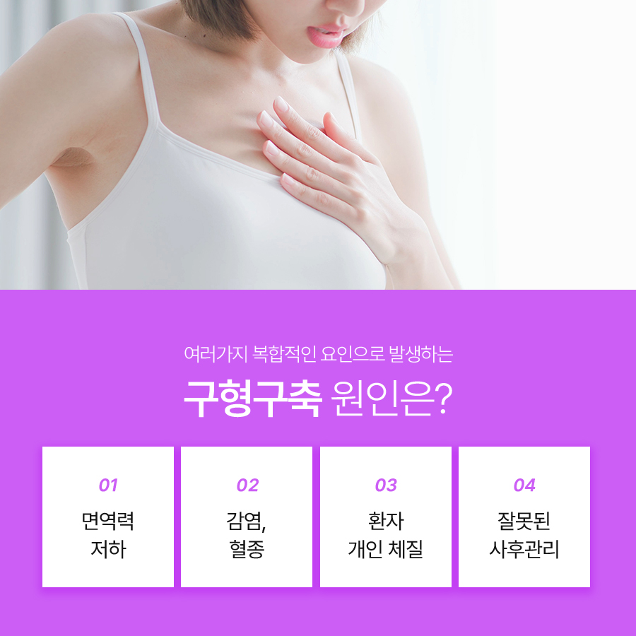 가슴구형구축원인, 가슴재수술 방법 알아보기 관련 이미지 5