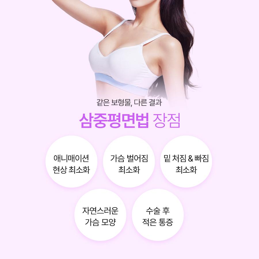 가슴재수술방법, 삼중평면법의 특징과 절개법 확인 관련 이미지 5