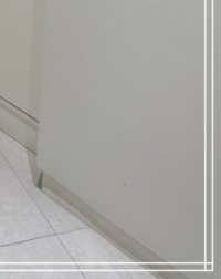 The Benefits of Breast Reduction Surgery: A Choice for Easier Movement image 27