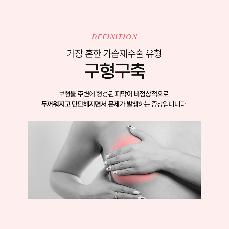 가슴구형구축수술 언제 필요하고 어떻게 진행될까? 관련 이미지 3