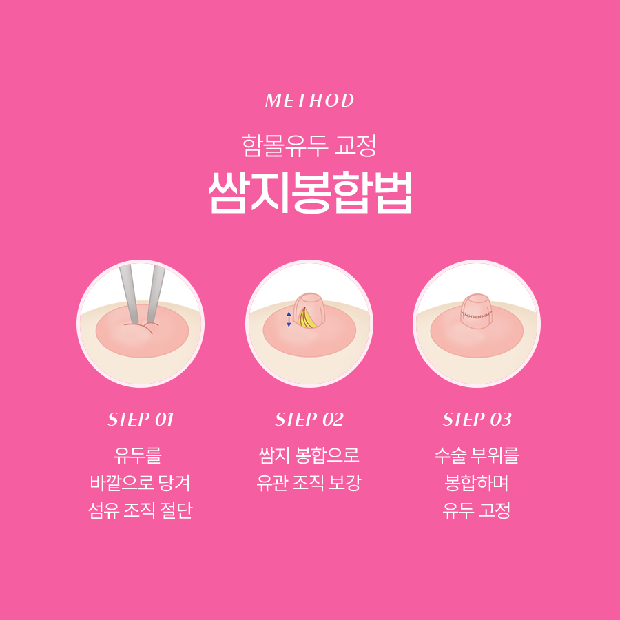 함몰유두 교정법 어떤 원리로 진행될까 관련 이미지 5