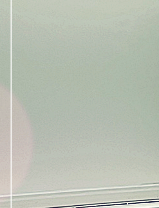 Accessory Breast Fat Removal: A Look at Accessory Breast Correction Considering Upper-Body Proportions image 22
