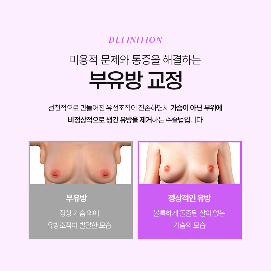 부유방제거수술 흉터 부유방이 생기는 이유 정리 관련 이미지 4