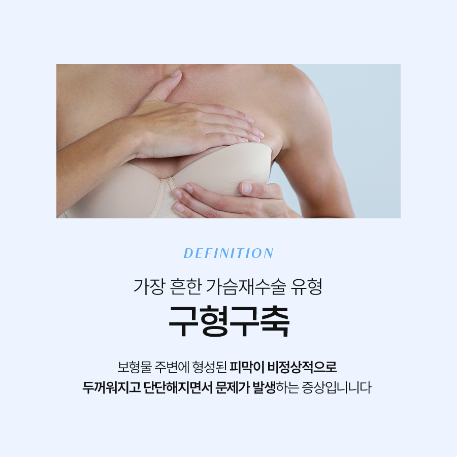 구형구축피막제거 재수술, 요즘은 이렇게 달라졌다 관련 이미지 3