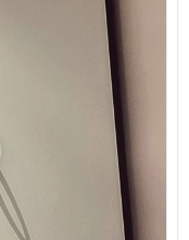 Breast Augmentation Incision Sites: Breast Revision Surgery Considering an Axillary Incision image 15