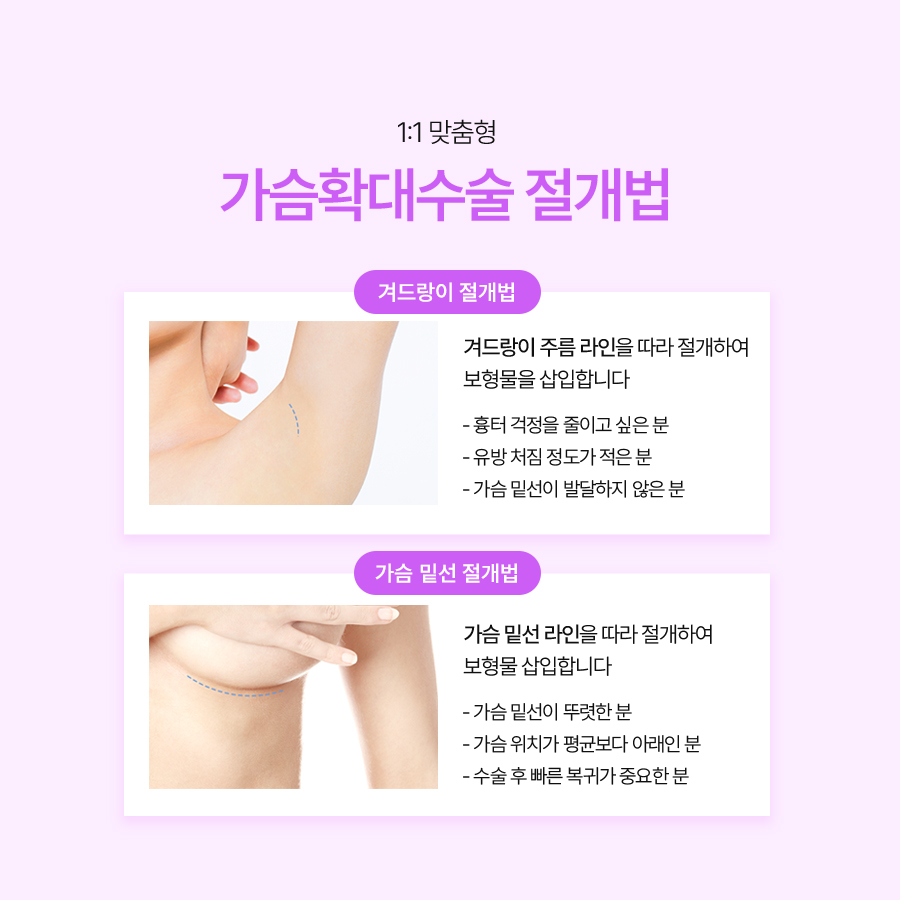 가슴재수술방법, 삼중평면법의 특징과 절개법 확인 관련 이미지 6