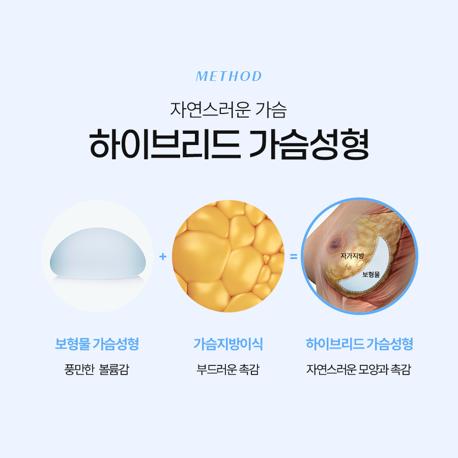 하이브리드가슴수술 촉감부터 라인까지 완벽 개선 관련 이미지 4