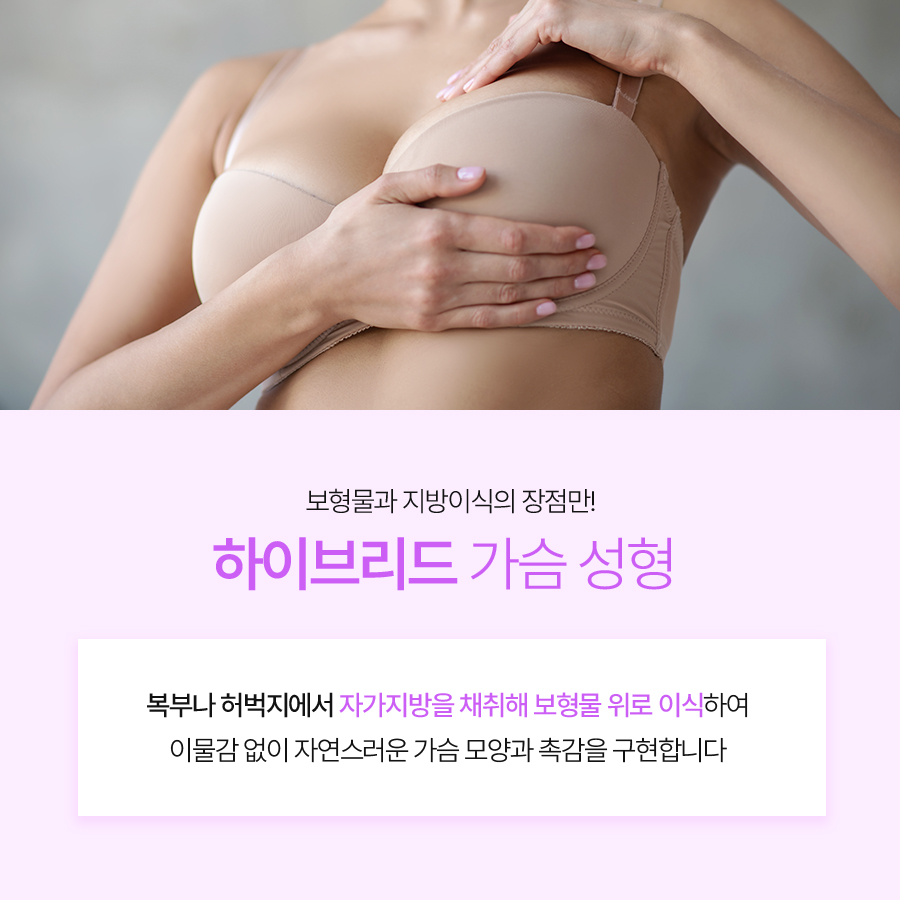 Hybrid Breast Augmentation Method: Volume and Shape at the Same Time image 3