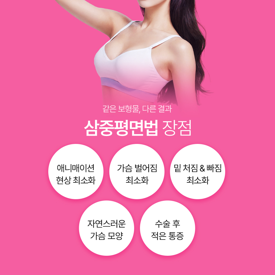 가슴재수술방법, 삼중평면법은 어떤 경우에 고려할까요? 관련 이미지 5