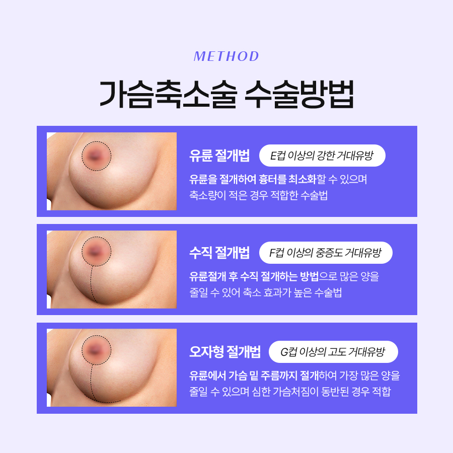 Breast Reduction Surgery: More Than Just a Simple ‘Size Reduction’ image 4