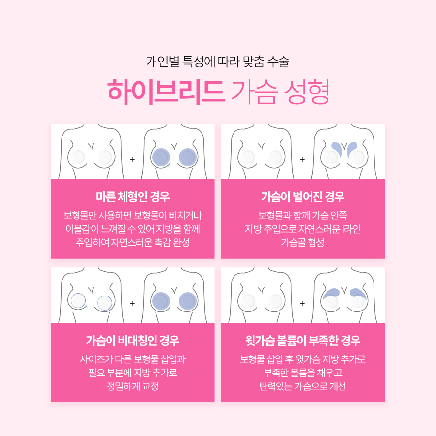 가슴지방이식수술 아름다운 라인, 이상적인 볼륨감 관련 이미지 5
