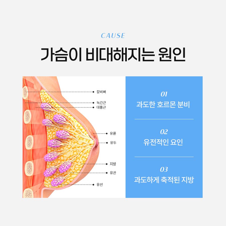 가슴축소성형수술 자연스러운 결과를 원한다면 관련 이미지 3