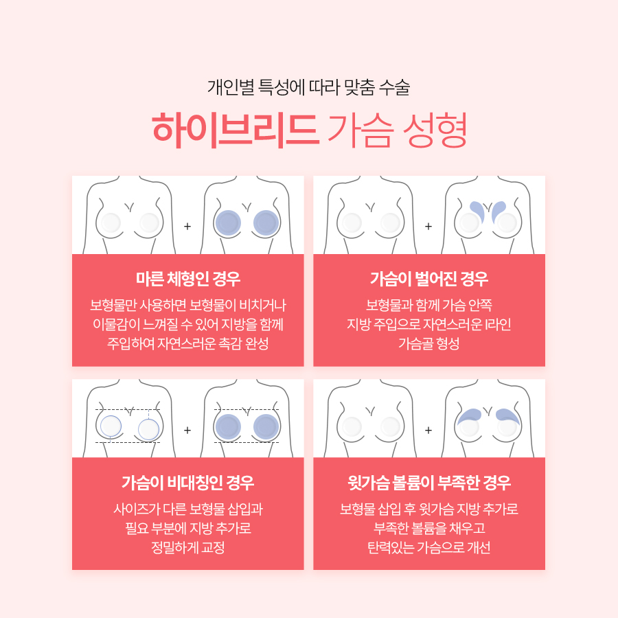 하이브리드가슴성형, 나에게 맞는 사이즈로 자연스럽게 관련 이미지 5
