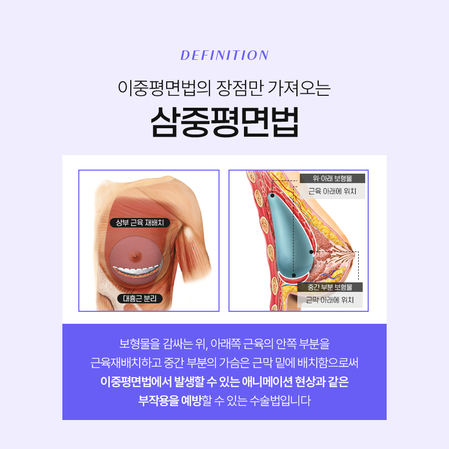 가슴확대수술비용 차이 나는 이유는? 관련 이미지 5