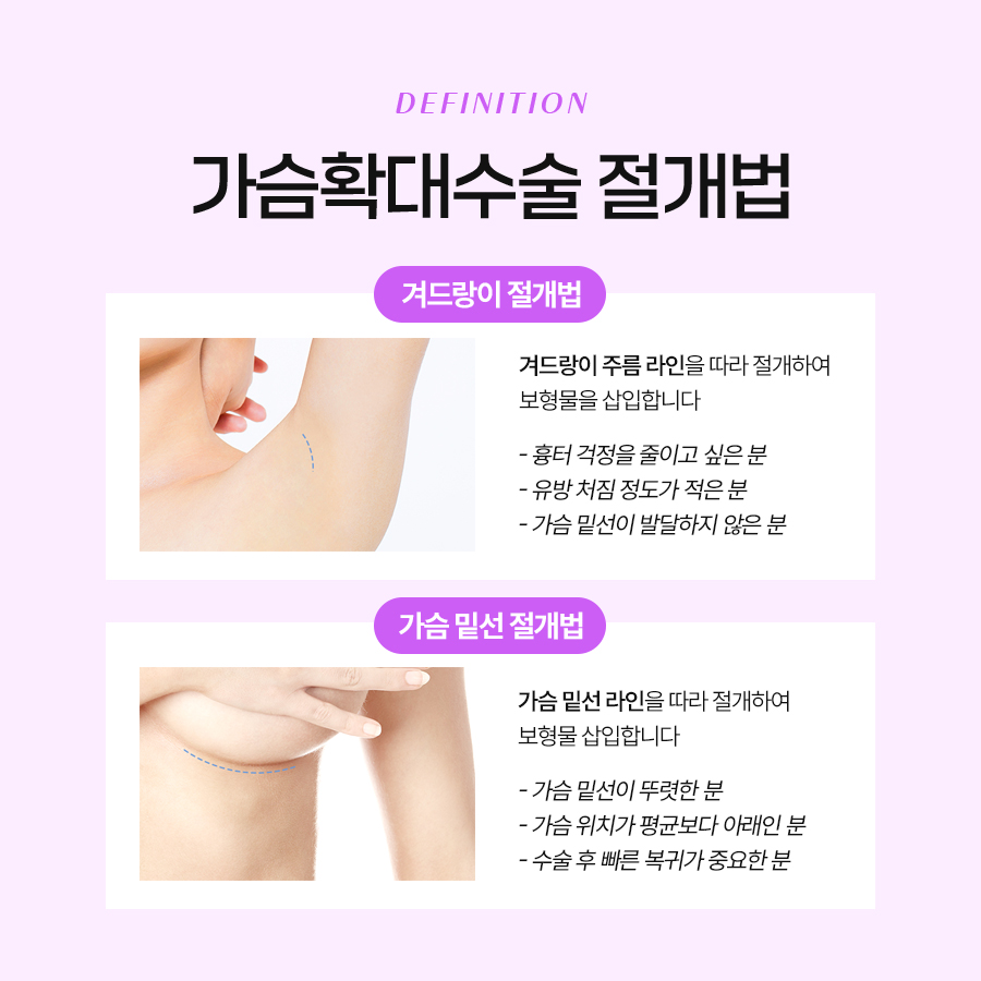 가슴성형잘하는병원 평면별 수술 접근 방식 관련 이미지 6