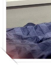 Breast Augmentation Incision Sites: Breast Revision Surgery Considering an Axillary Incision image 16