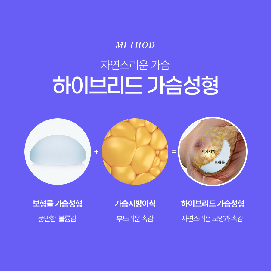 하이브리드가슴성형 자연스러움과 볼륨을 모두 잡는 선택 관련 이미지 4