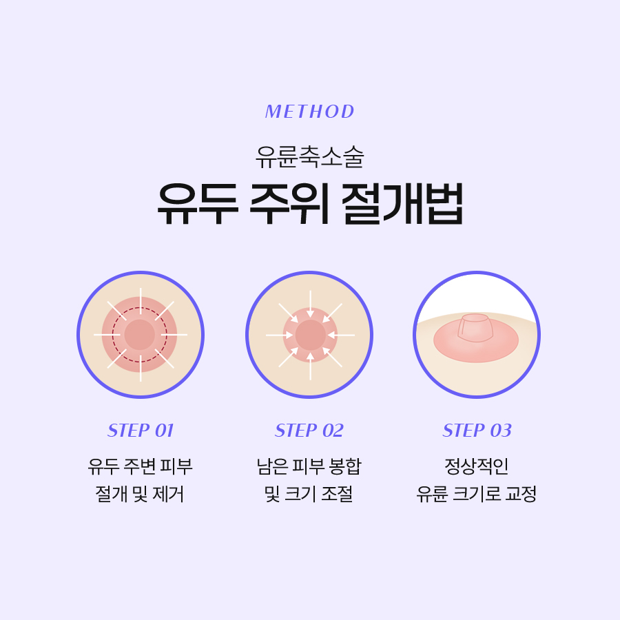가슴유륜축소술 수술 후 기대할 수 있는 변화 관련 이미지 4