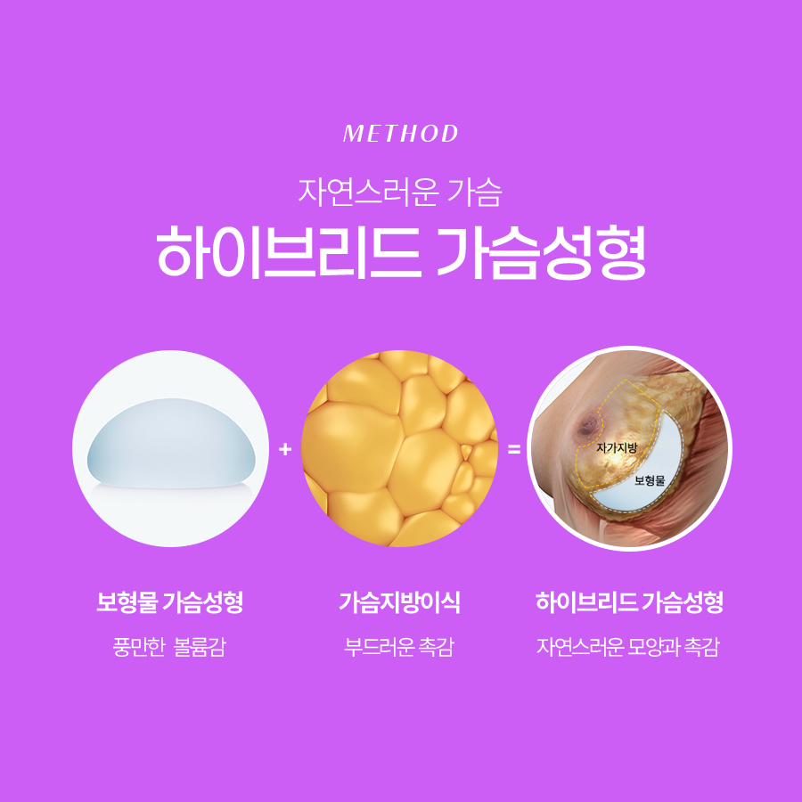 하이브리드가슴수술 일반 가슴성형과 뭐가 다를까? 관련 이미지 4