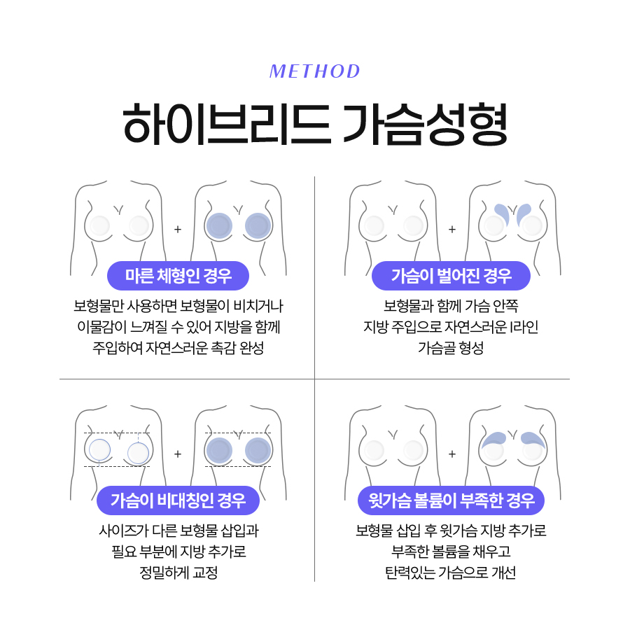하이브리드가슴성형 자연스러움과 볼륨감을 동시에! 관련 이미지 4
