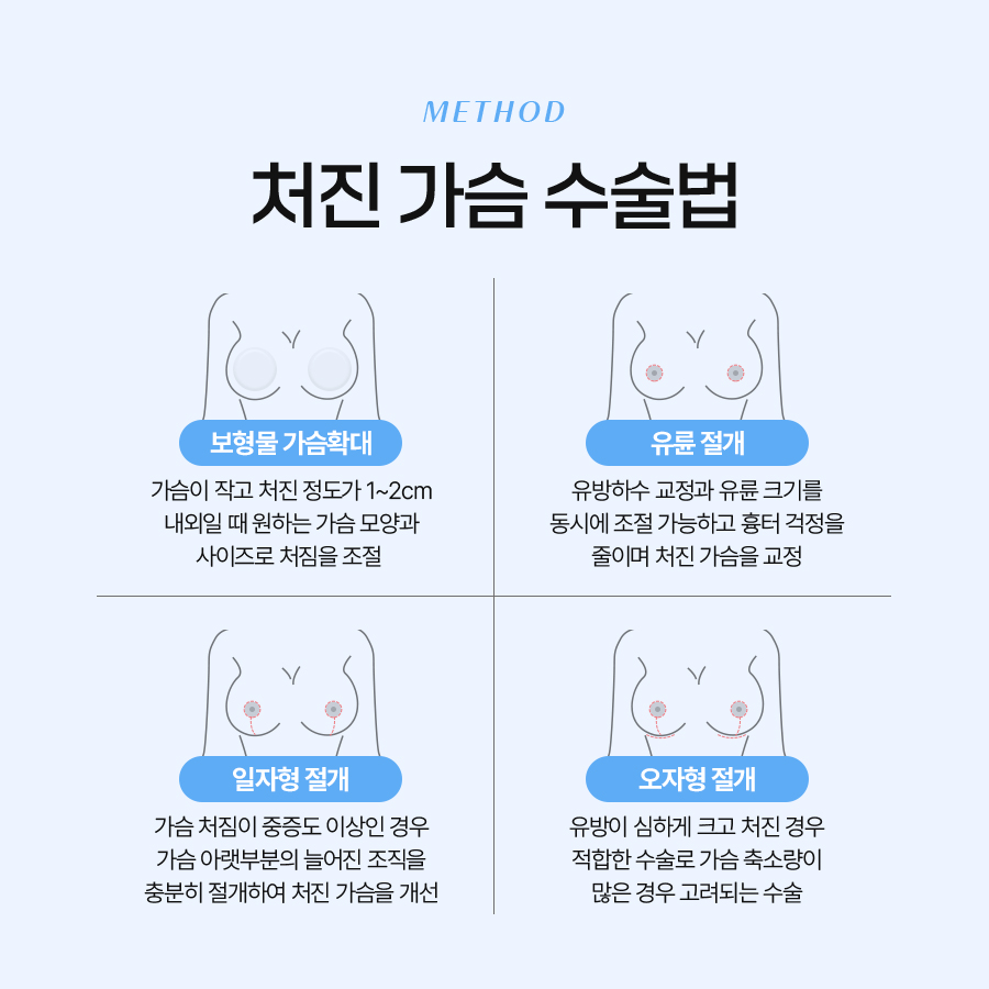 유방하수교정수술 자연스러움과 탄력을 되찾는 길 관련 이미지 6