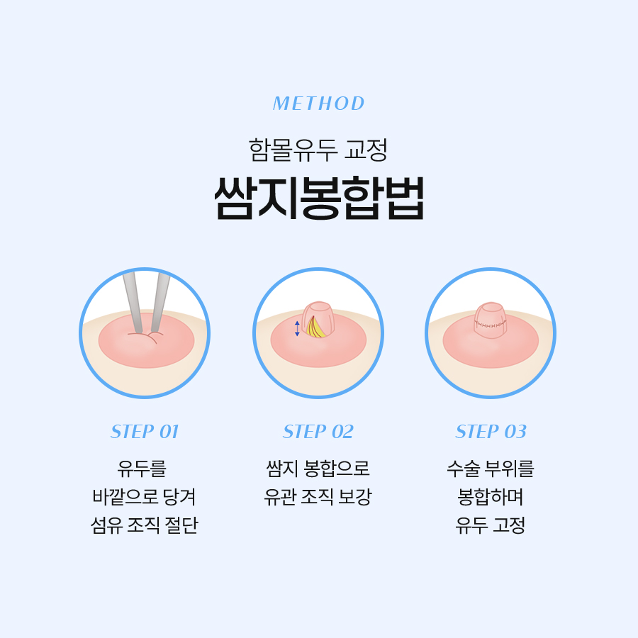 함몰유두교정술, 자신감을 되찾는 첫걸음 관련 이미지 5