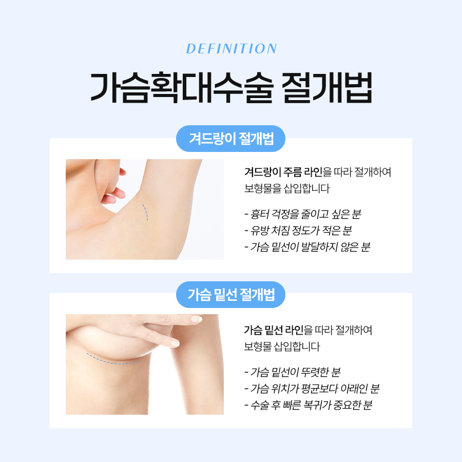 가슴 볼륨 수술 나에게 맞는 방법과 종류 총정리 관련 이미지 3