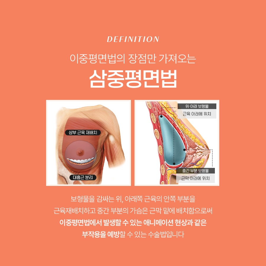 Key Points You Must Know Before Undergoing Axillary Incision Breast Revision Surgery image 6