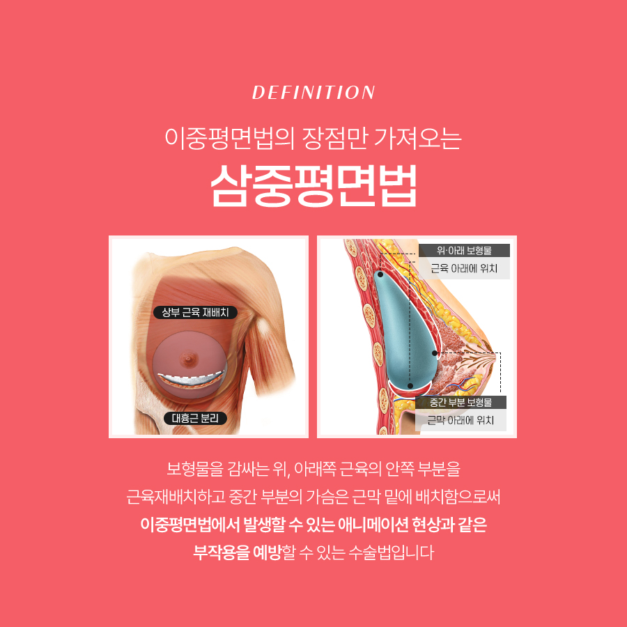 애니메이션 현상 왜 생기고 어떻게 개선할까? 관련 이미지 5