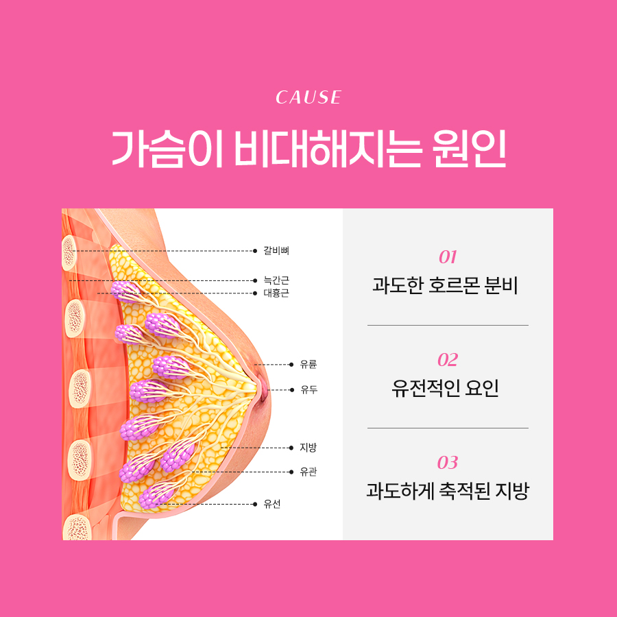가슴거대유방증 해결, 가슴축소수술로 가능한 이유 관련 이미지 3