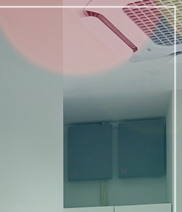 If you’re wondering which implant is best for Motiva breast augmentation image 21