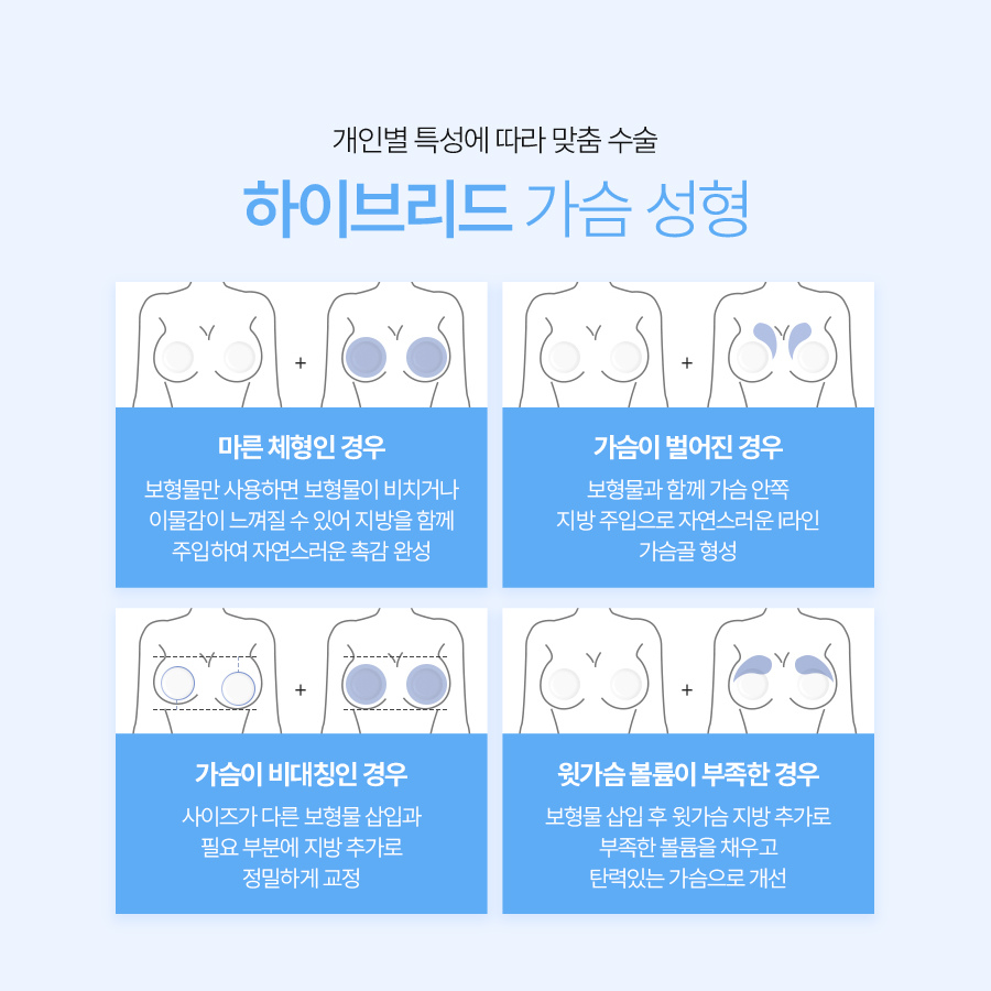 하이브리드가슴수술 자연스러움의 비결 관련 이미지 6