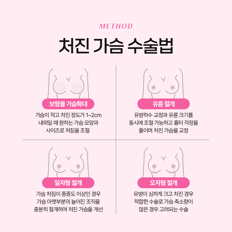 중년가슴성형 처진 가슴 자연스럽게 되돌리는 방법 관련 이미지 6