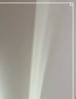 지방이식가슴성형 효과 높이는 하이브리드 수술법 관련 이미지 21