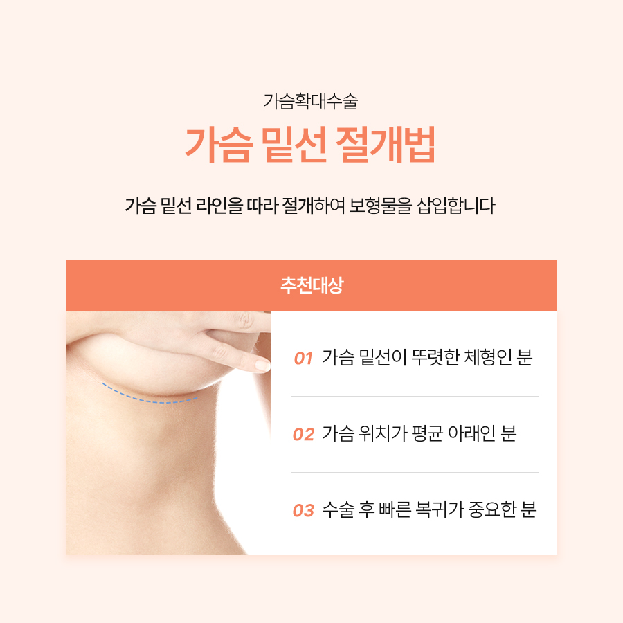 What Determines the Results of Breast Augmentation for a Flat Chest and Natural-Looking Volume? image 5