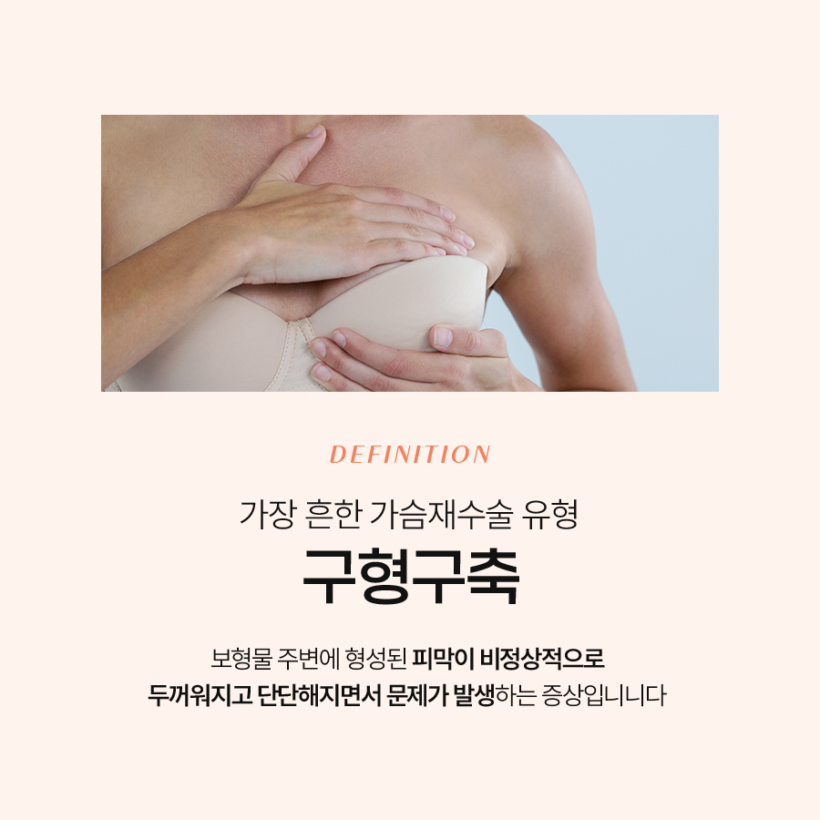 가슴구형구축재수술 첫 수술과 다른 점은 무엇일까 관련 이미지 3
