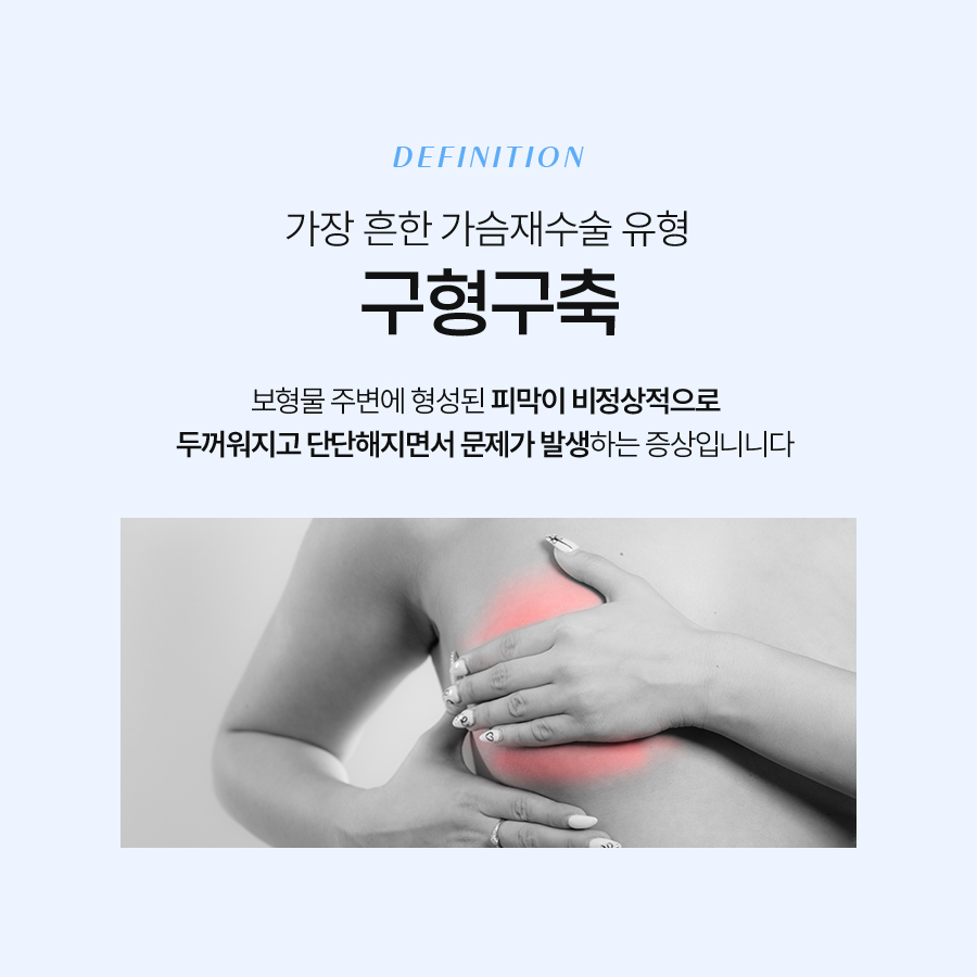 가슴구형구축 재수술 전 반드시 확인해야 할 모든 것 관련 이미지 3