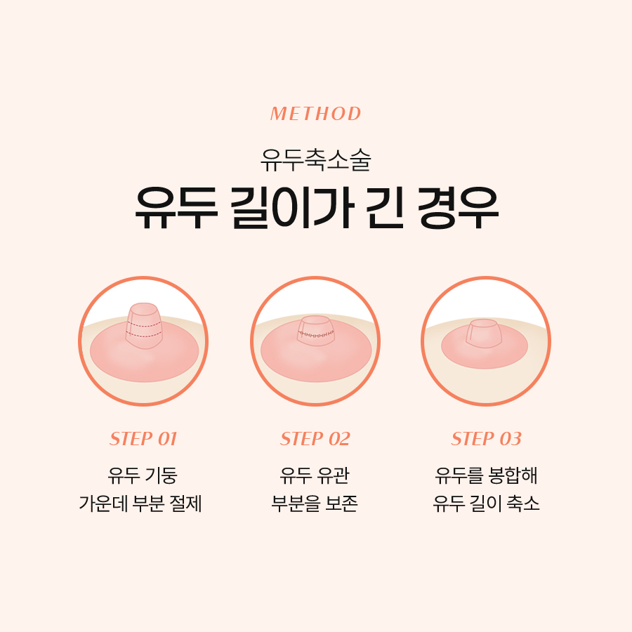 가슴유두축소수술 후 기대할 수 있는 변화 관련 이미지 6