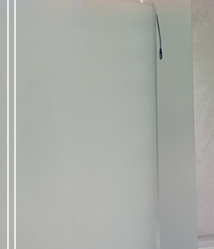 Why Mentor Xtra Breast Augmentation Looks Natural Even Over Time image 13