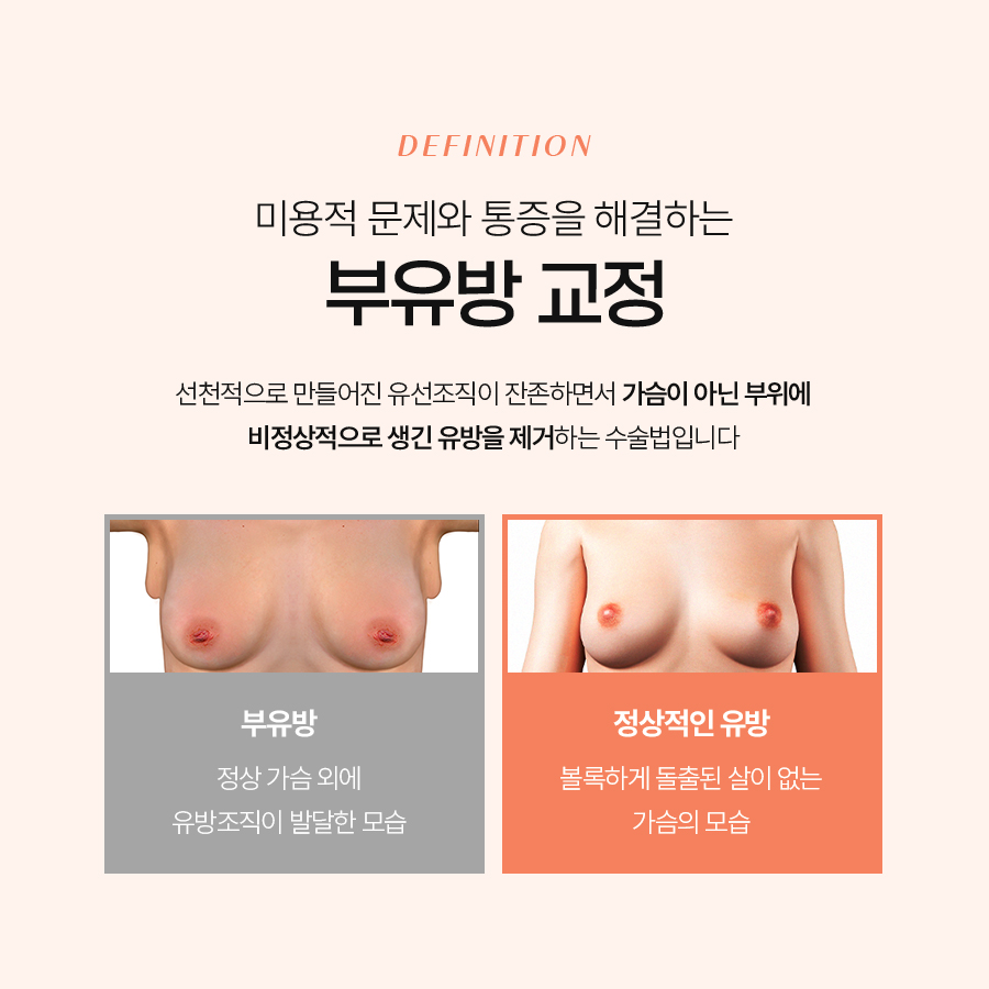 부유방교정 아름다운 몸매를 위한 첫걸음 관련 이미지 4