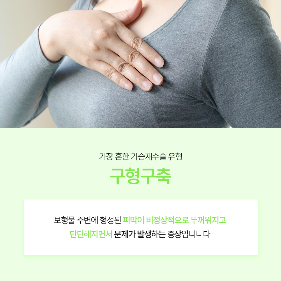 Understanding and Choosing Breast Revision Surgery for Capsular Contracture image 3