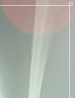 Breast Plastic Surgery Clinic Reviews: What to Know Before Breast Augmentation Surgery image 21