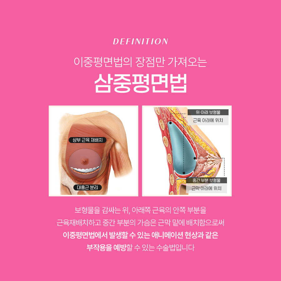 Breast Augmentation Surgery: Which Method Is Safest? image 6