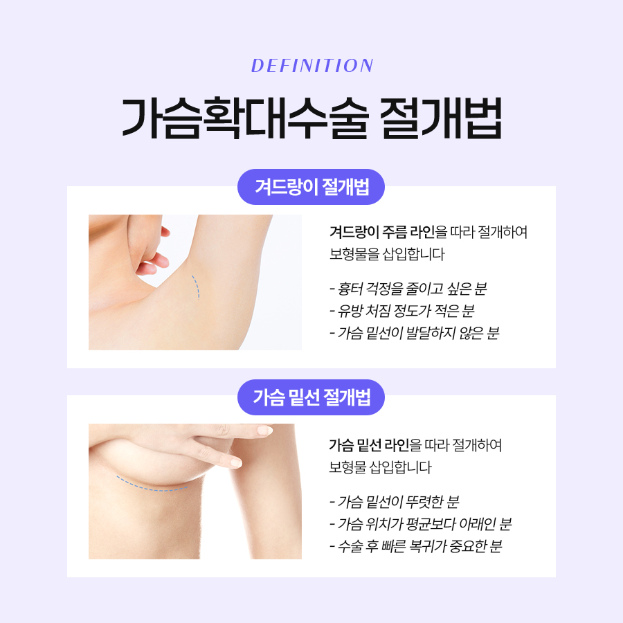 가슴확대수술방법 종류별 특징은? 관련 이미지 4